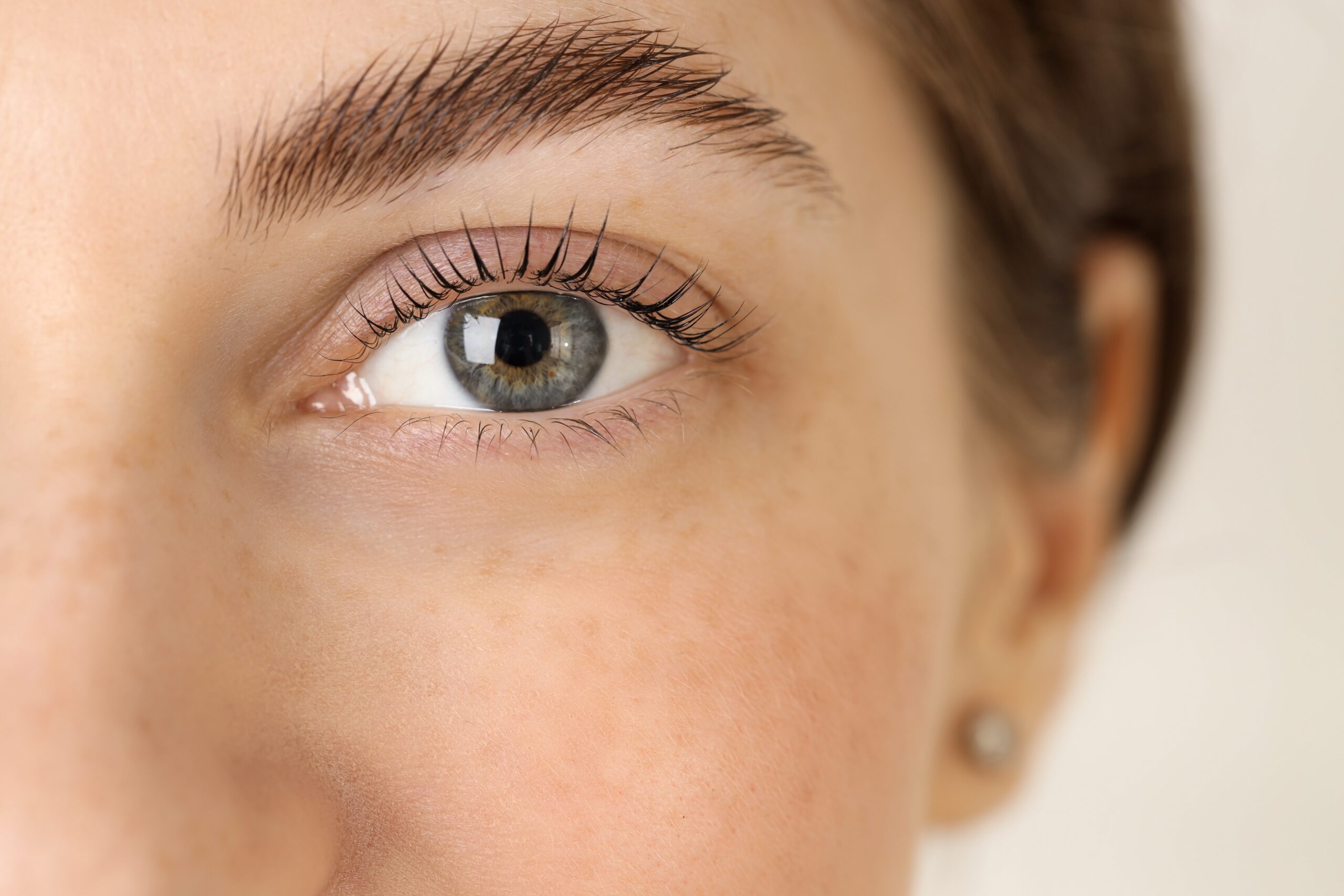 Woman | Eyelid Surgery